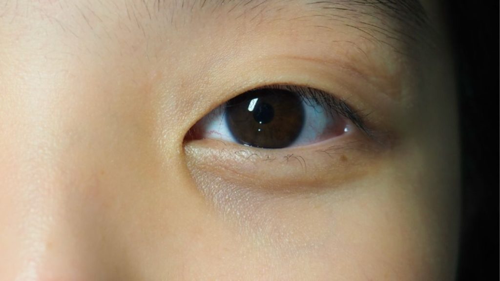 Monolid Lash Lift